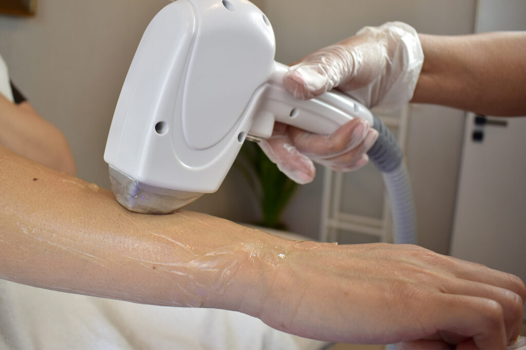 Orijinal Buz Diot Lazer